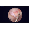 2,7 mm Arthroskop
